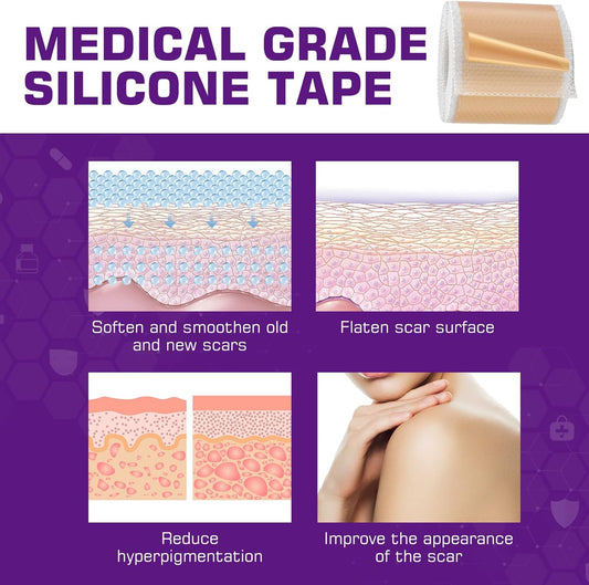 Scar Silicone Gel Sheets for Surgery: Advanced Scar Removal Sheets for Old and New Scars from Stretch Marks - C Section - Burns - Acne - Injury - Keloid Treatment for Skin Types of Ears - Face - Body