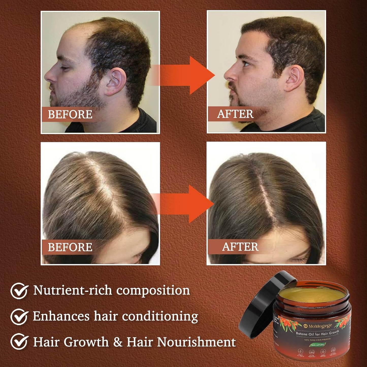 Organic Batana Oil For Hair Growth: Dr Sebi Pure Batana Oil for Women & Men - 100% Raw Honduras Hair Growth Product for preventing hair loss. 4.2 OZ